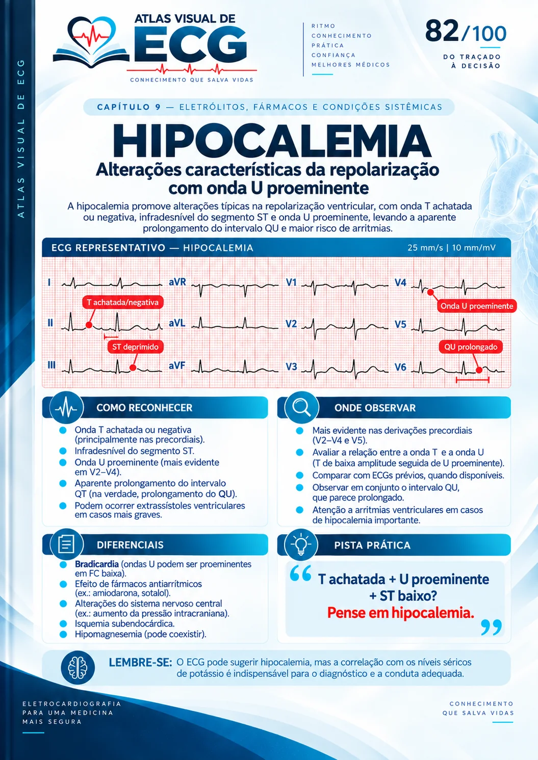 ECG 082