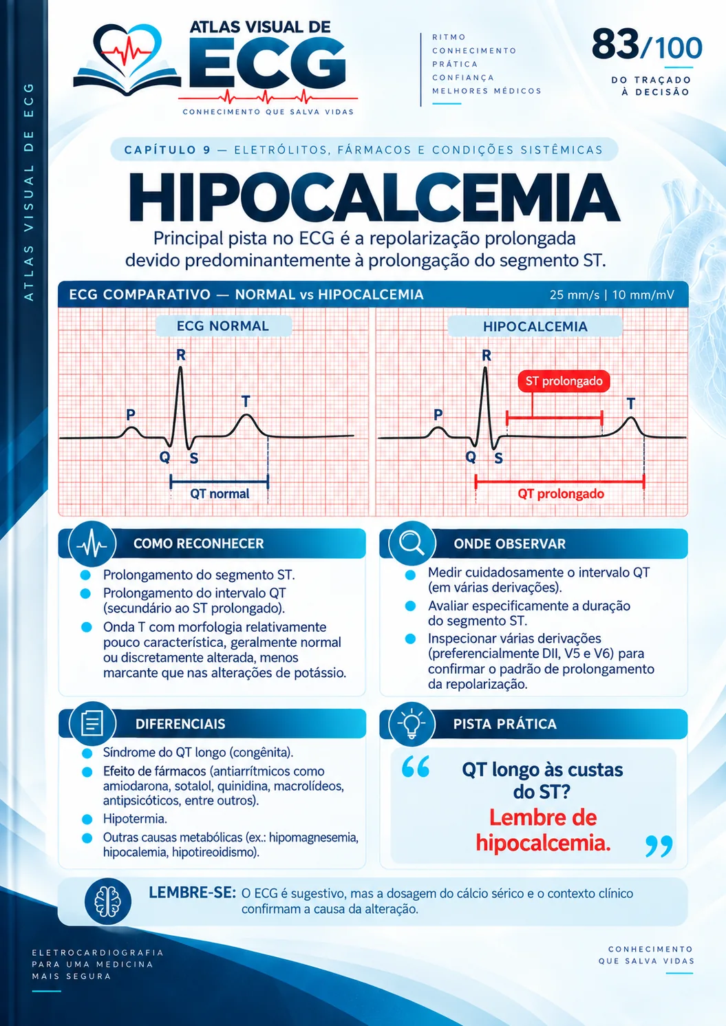 ECG 083