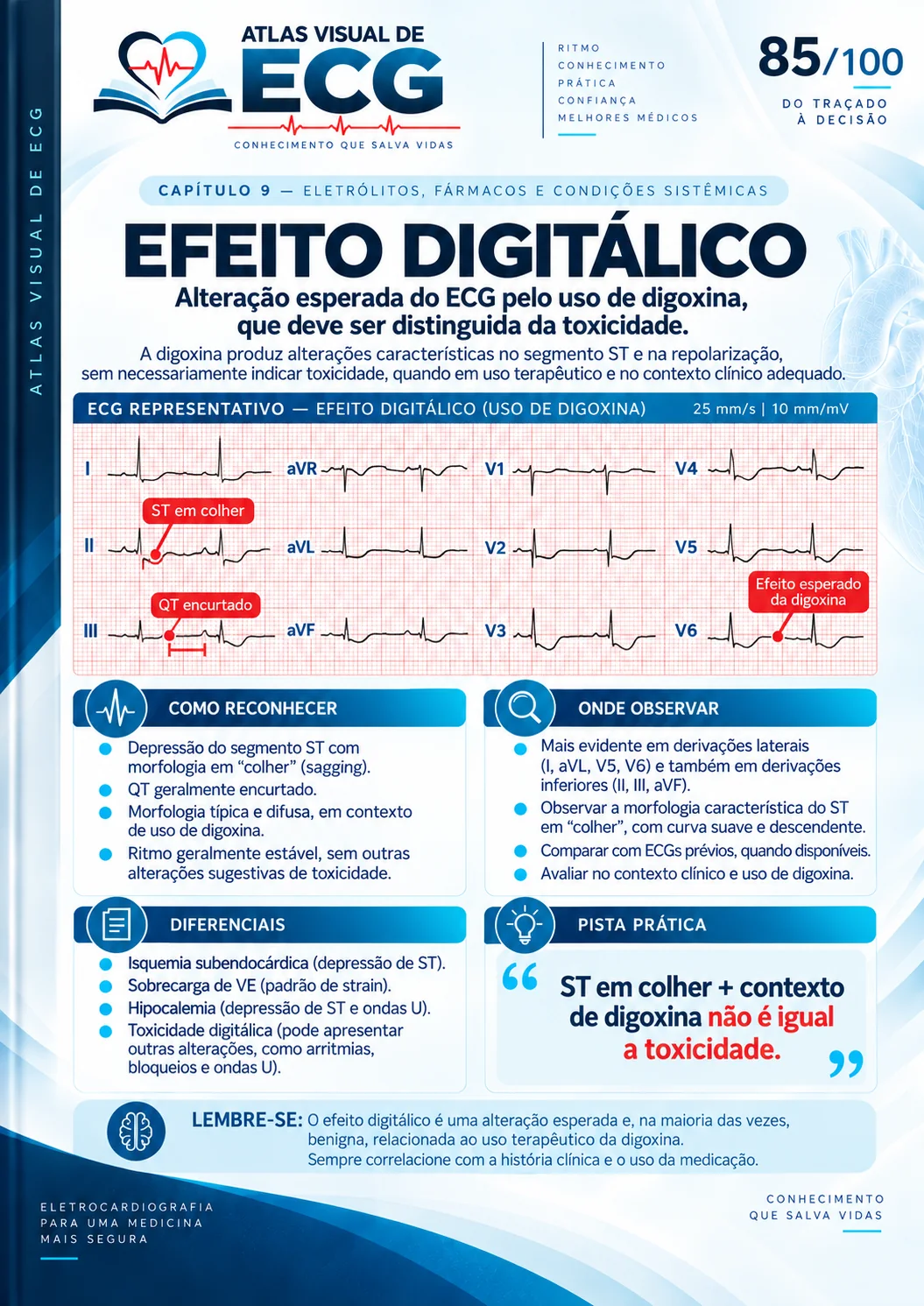 ECG 085