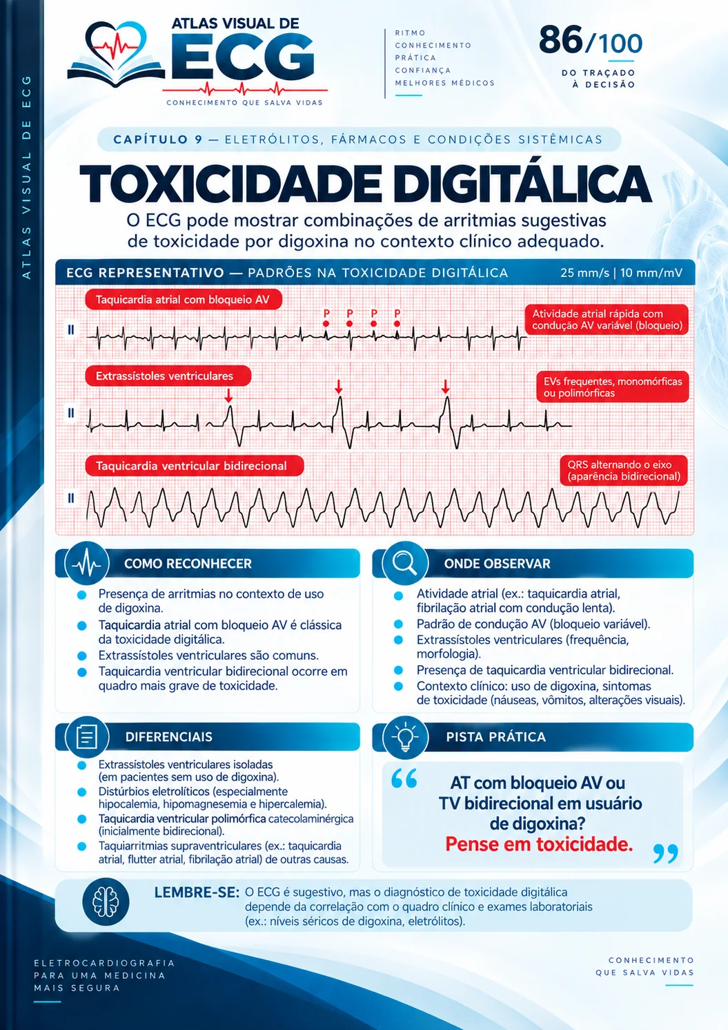 ECG 086