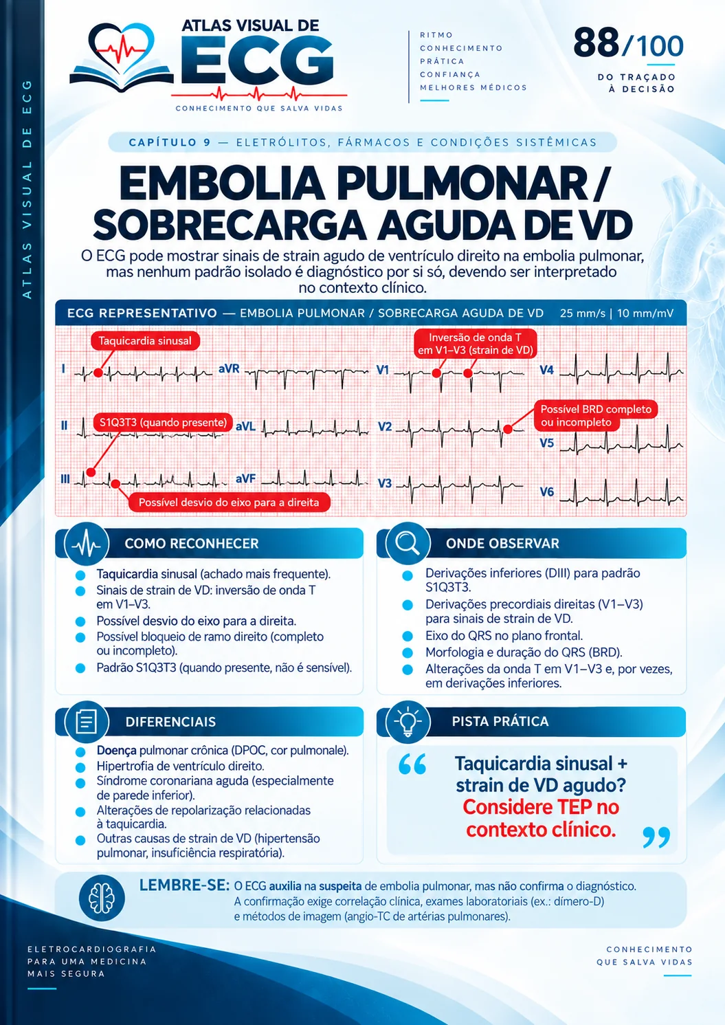 ECG 088