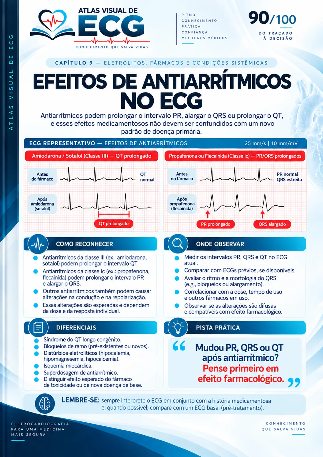 ECG 090