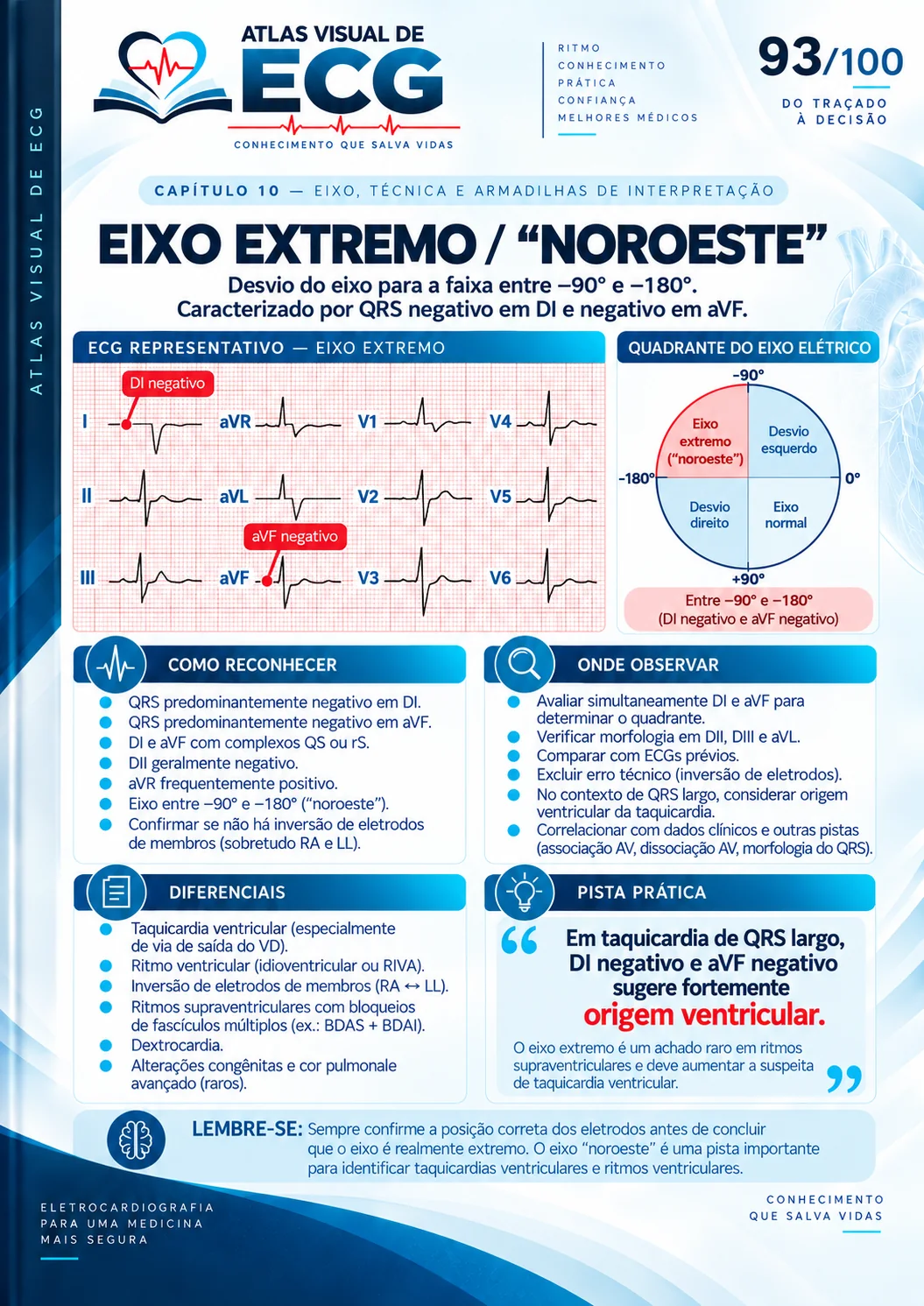 ECG 093