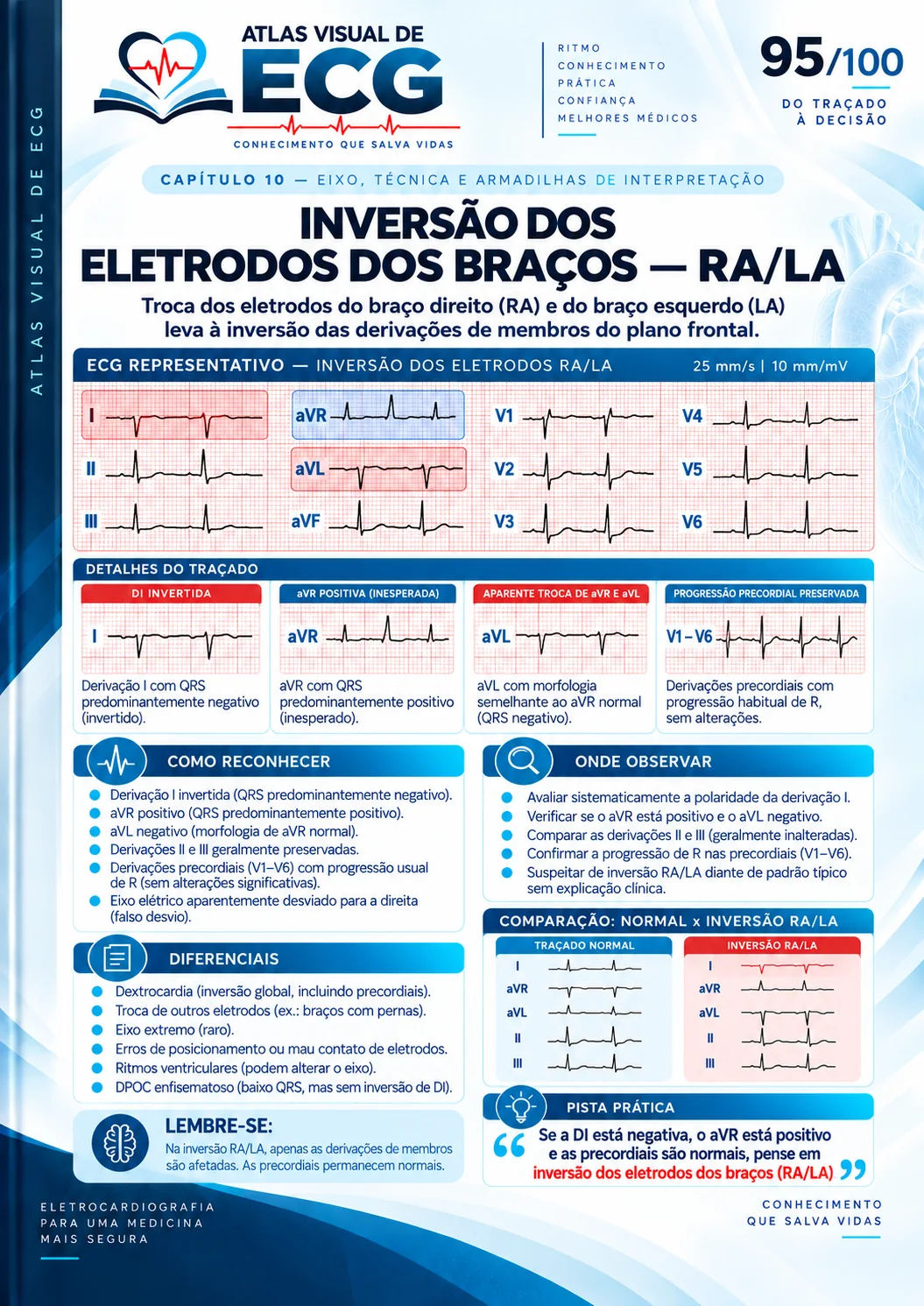 ECG 095