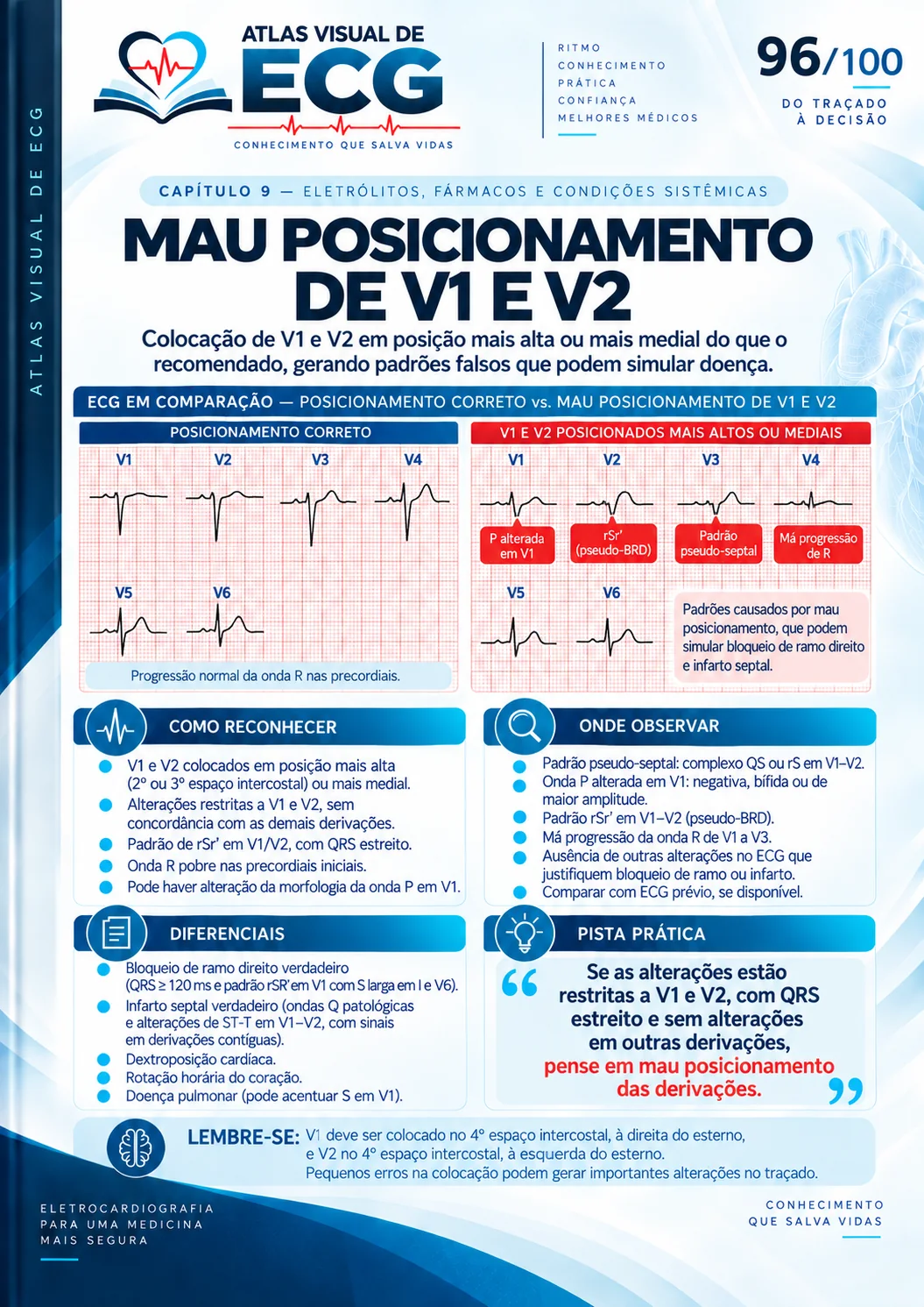 ECG 096