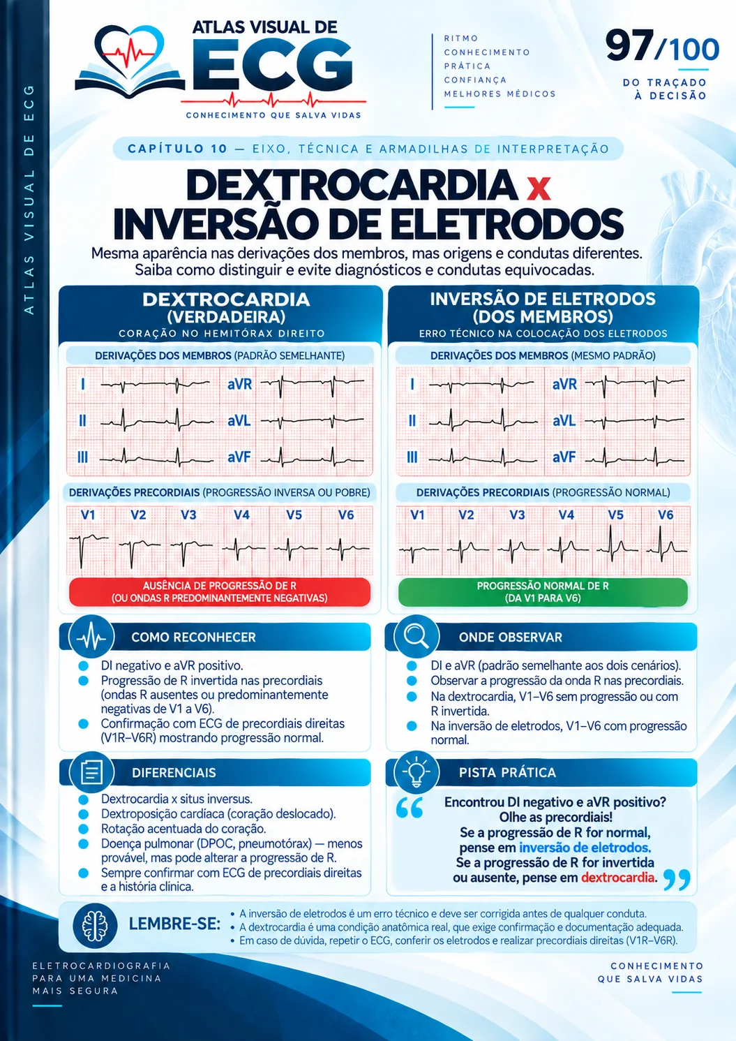 ECG 097