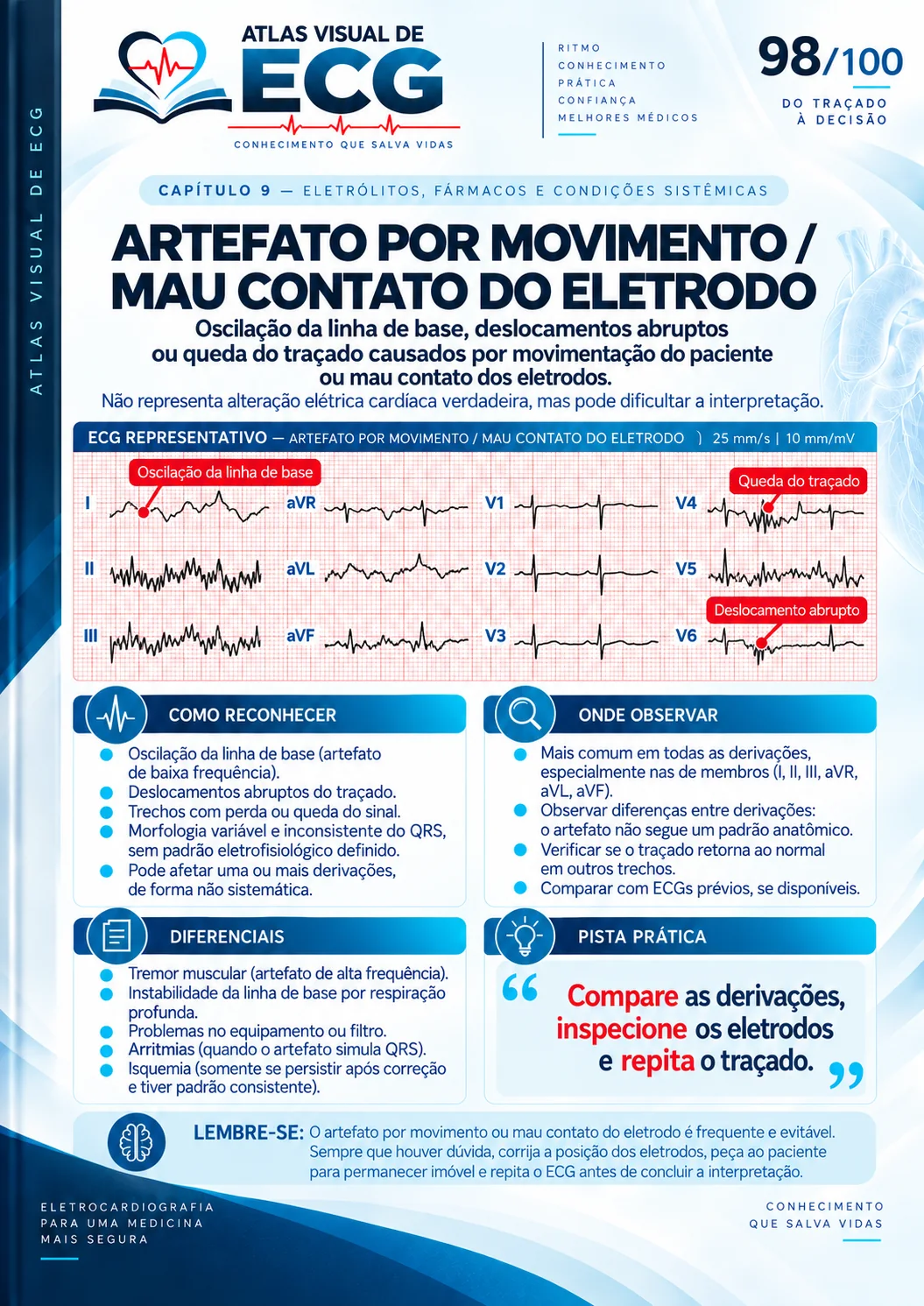 ECG 098