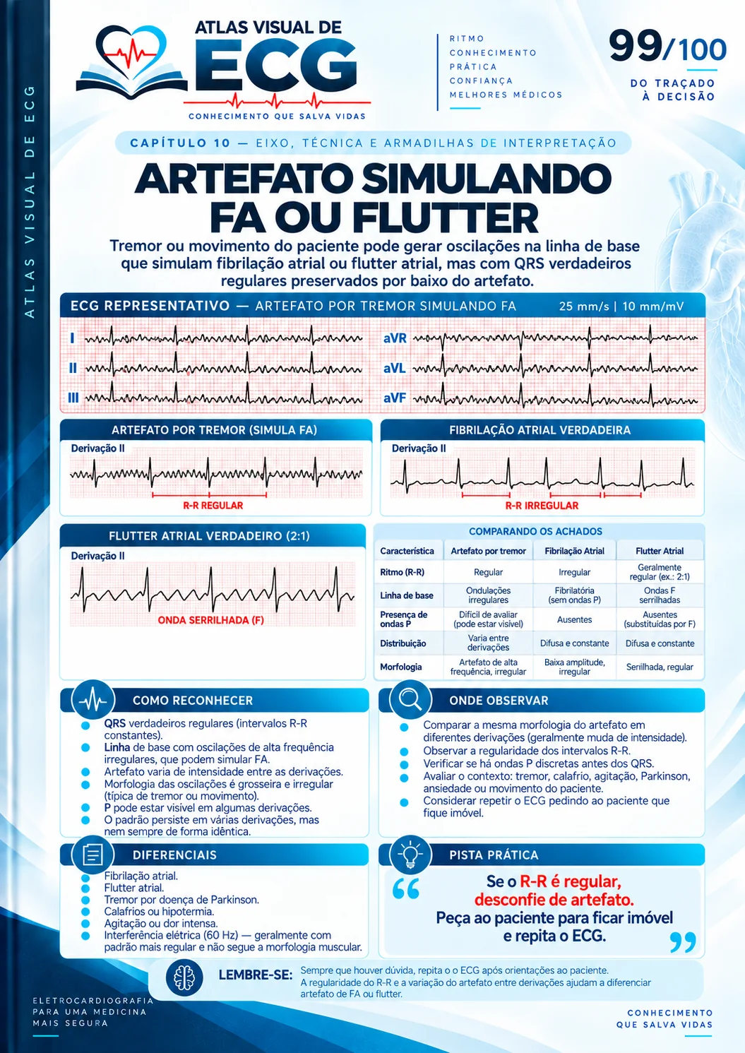 ECG 099